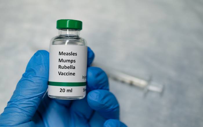 The Return of the Measles | What Parents Should Know